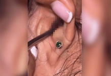 SVRBELO JE UVO DO BESVESTI, OTIŠLA U BOLNICU, A TAMO ŠOK: Kada su videli šta je unutra nisu mogli da veruju svojim očima! (FOTO)