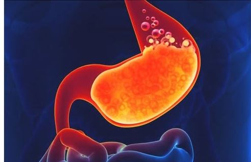 Ova hrana je najveći neprijatelj za želudac – Evo koje namirnice ne smijete jesti pred spavanje! - featured image