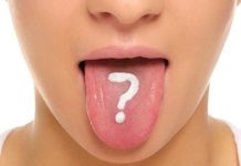 ODMAH POGLEDAJTE DA LI I VI IMATE OVO NA JEZIKU: To je znak da vam se dešavaju ove dvije stvari, PRVA VAM SE NIKAKO NEĆE DOPASTI