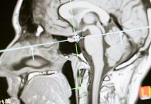 Zašto neki mozgovi ne mogu da se isključe noću uprkos umoru: Njegov prekovremeni rad traje satima