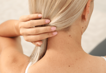 OTKRIJTE ISTINU Šta znači ako imate mladež na licu, ruci ili stopalu