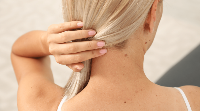 OTKRIJTE ISTINU Šta znači ako imate mladež na licu, ruci ili stopalu