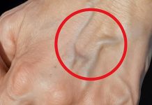 Ako imaš vidljive vene, to znači da si…😨😨‼️