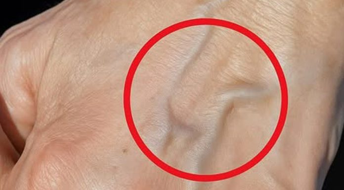 Ako imaš vidljive vene, to znači da si…😨😨‼️