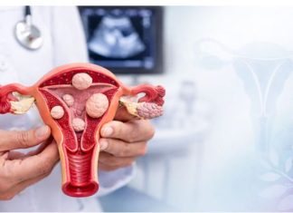Žene obratite pažnju: Ovo su prvi simptomi mioma materice, obično ih je više, a ovi su najčešći