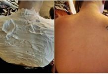 Izgorela je na suncu, a ovo ju je spasilo za 30 minuta: Svi to imamo u kući, a nije jogurt