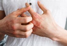 Umor, svrab, VISOK KRVNI PRITISAK, BOL U LEĐIMA – Ova bolest je ”TIHI UBICA”, obratite pažnju ako imate neke od ovih simptoma Umor, svrab, VISOK KRVNI PRITISAK, BOL U LEĐIMA – Ova bolest je ”TIHI UBICA”, obratite pažnju ako imate neke od ovih simptoma - featured image