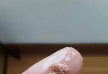 Bele grudvice u jajetu: šta to zaista znači i da li treba da brinete? Bele grudvice u jajetu: šta to zaista znači i da li treba da brinete? - featured image