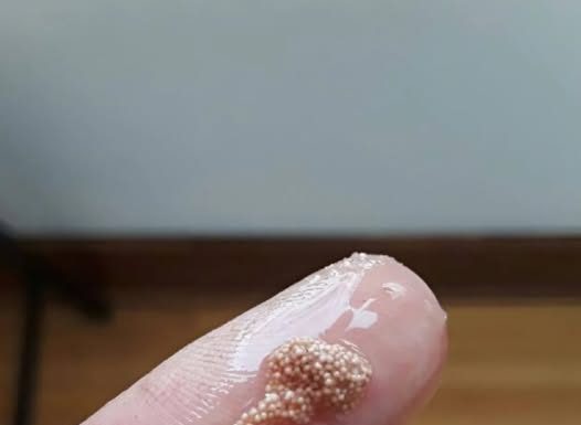 Bele grudvice u jajetu: šta to zaista znači i da li treba da brinete? Bele grudvice u jajetu: šta to zaista znači i da li treba da brinete? - featured image