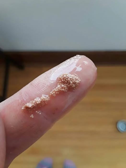 Bele grudvice u jajetu: šta to zaista znači i da li treba da brinete? - featured image